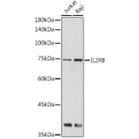 Western Blot - Anti-IL2 Receptor beta/p75 Antibody (A9815) - Antibodies.com