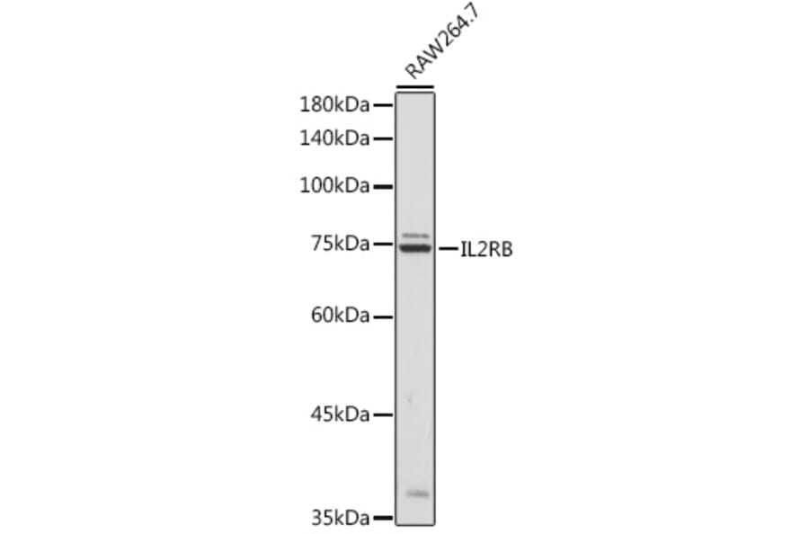 Western Blot - Anti-IL2 Receptor beta/p75 Antibody (A9815) - Antibodies.com