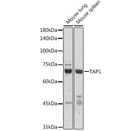 Western Blot - Anti-TAP1 Antibody (A9816) - Antibodies.com