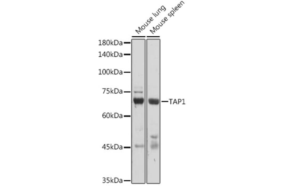 Western Blot - Anti-TAP1 Antibody (A9816) - Antibodies.com