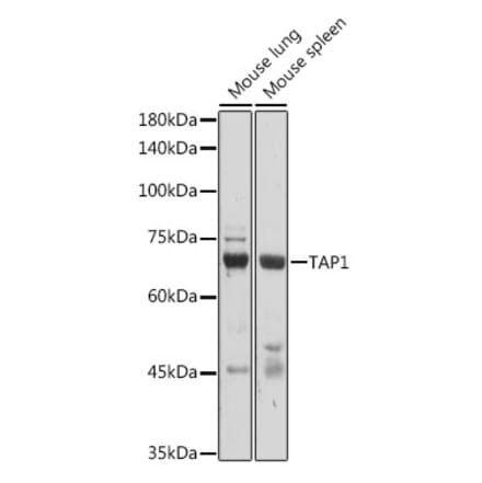 Western Blot - Anti-TAP1 Antibody (A9816) - Antibodies.com