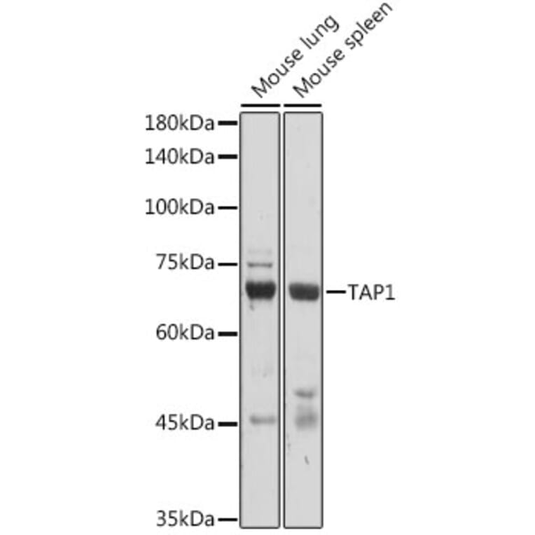 Western Blot - Anti-TAP1 Antibody (A9816) - Antibodies.com