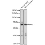 Western Blot - Anti-TAP1 Antibody (A9816) - Antibodies.com