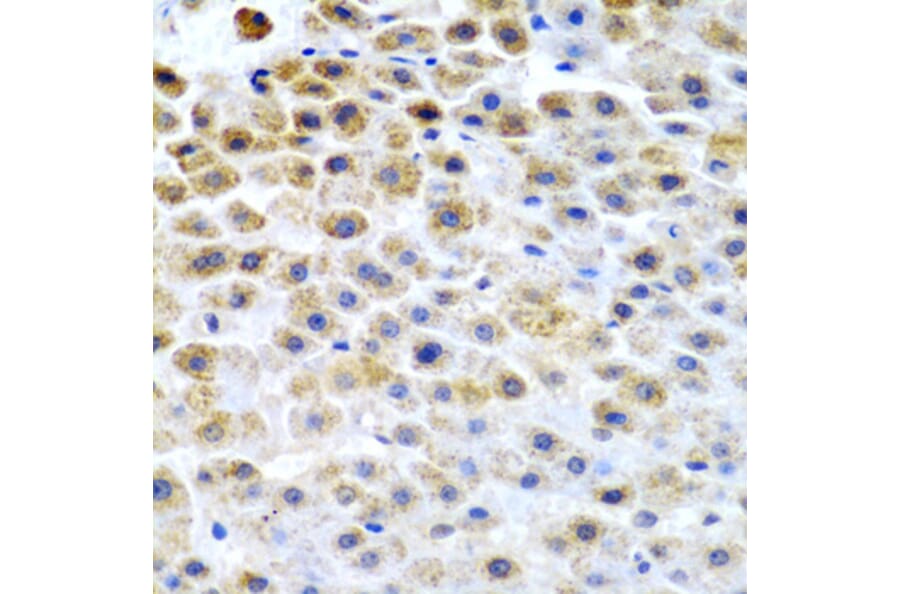Immunohistochemistry - Anti-TFPI2 Antibody (A9817) - Antibodies.com