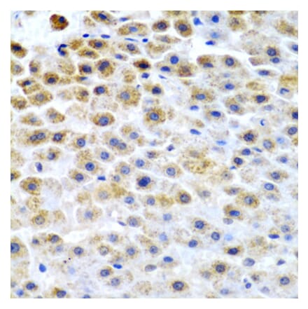 Immunohistochemistry - Anti-TFPI2 Antibody (A9817) - Antibodies.com