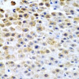 Immunohistochemistry - Anti-TFPI2 Antibody (A9817) - Antibodies.com