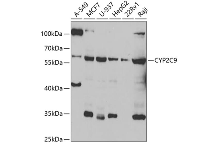 Western Blot - Anti-CYP2C9 Antibody (A6219) - Antibodies.com