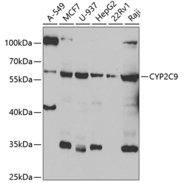 Western Blot - Anti-CYP2C9 Antibody (A6219) - Antibodies.com