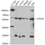 Western Blot - Anti-CYP2C9 Antibody (A6219) - Antibodies.com