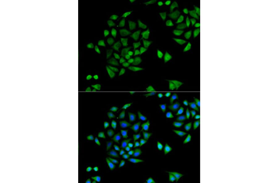 Immunofluorescence - Anti-CYP2C9 Antibody (A6219) - Antibodies.com