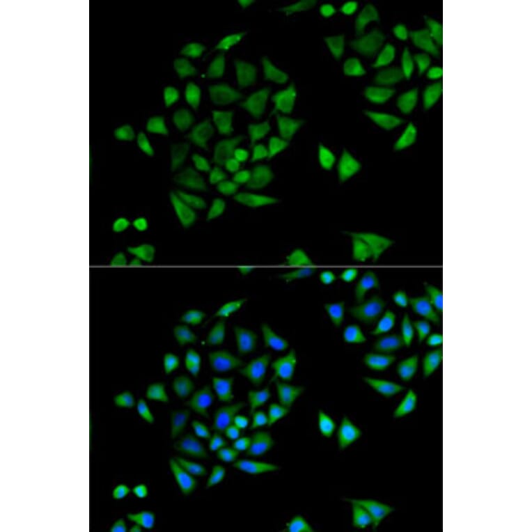 Immunofluorescence - Anti-CYP2C9 Antibody (A6219) - Antibodies.com