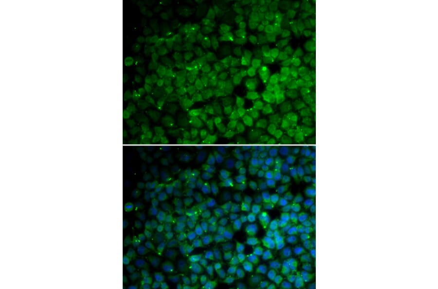 Immunofluorescence - Anti-TRIM13 Antibody (A6225) - Antibodies.com