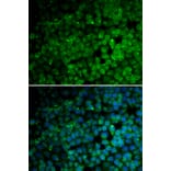 Immunofluorescence - Anti-TRIM13 Antibody (A6225) - Antibodies.com