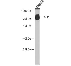 Western Blot - Anti-intestinal alkaline phosphatase Antibody (A9820) - Antibodies.com