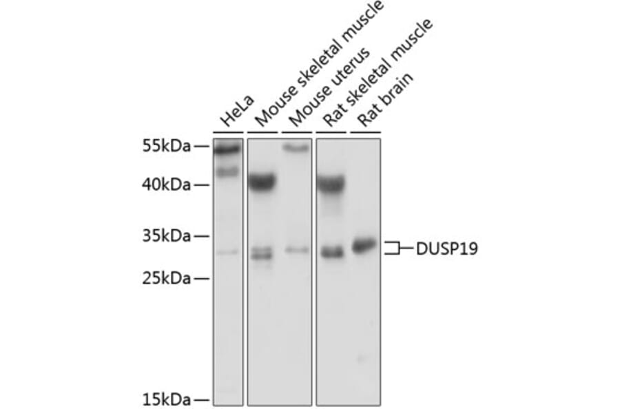 Western Blot - Anti-DUSP19 Antibody (A6227) - Antibodies.com