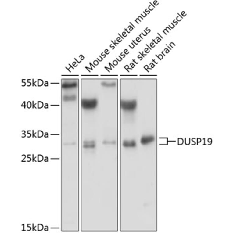 Western Blot - Anti-DUSP19 Antibody (A6227) - Antibodies.com