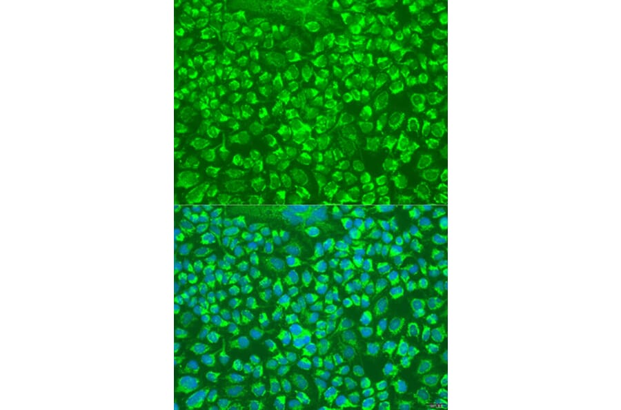 Immunofluorescence - Anti-Granzyme A Antibody (A9822) - Antibodies.com