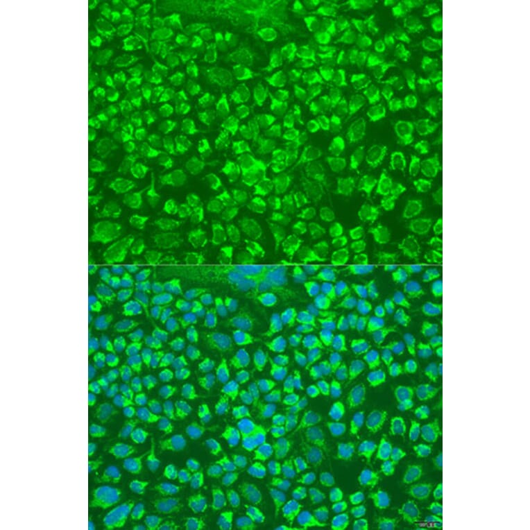 Immunofluorescence - Anti-Granzyme A Antibody (A9822) - Antibodies.com