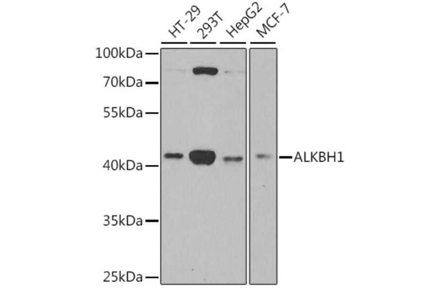 Western Blot - Anti-ALKBH1 Antibody (A9823) - Antibodies.com
