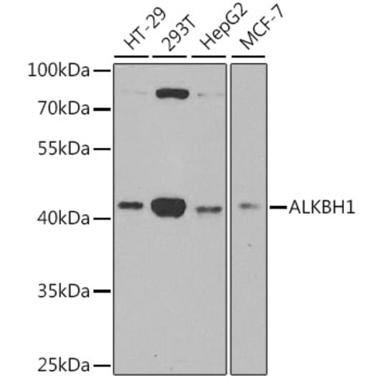 Western Blot - Anti-ALKBH1 Antibody (A9823) - Antibodies.com