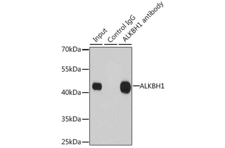 Western Blot - Anti-ALKBH1 Antibody (A9823) - Antibodies.com