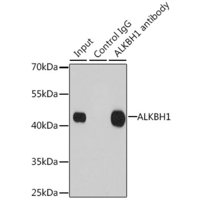 Western Blot - Anti-ALKBH1 Antibody (A9823) - Antibodies.com