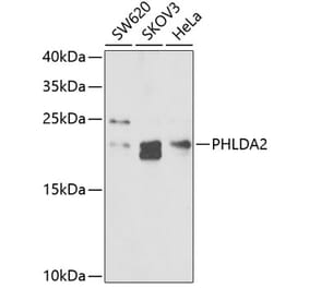 Western Blot - Anti-TSSC3 Antibody (A9824) - Antibodies.com