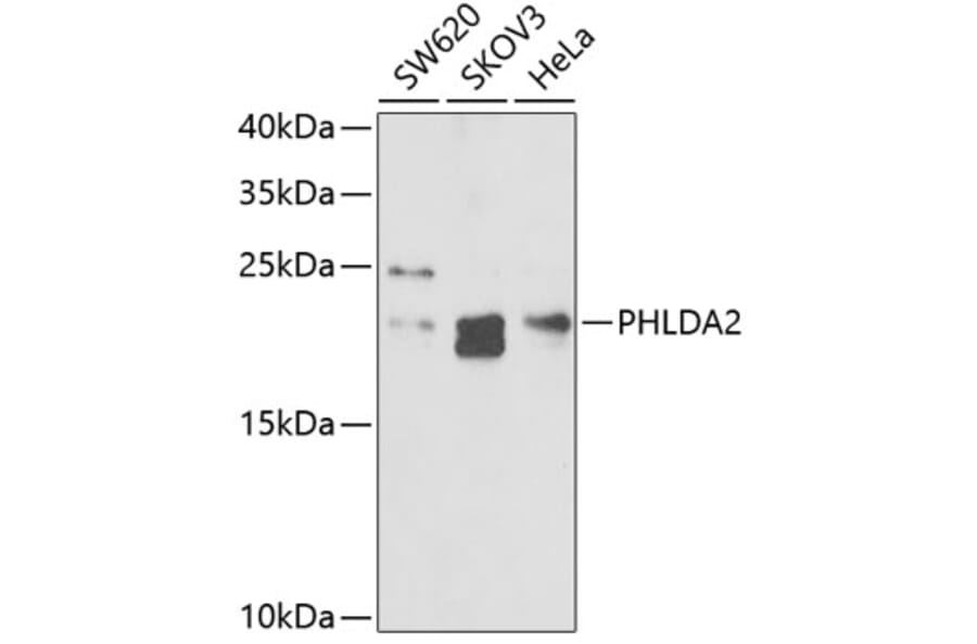 Western Blot - Anti-TSSC3 Antibody (A9824) - Antibodies.com