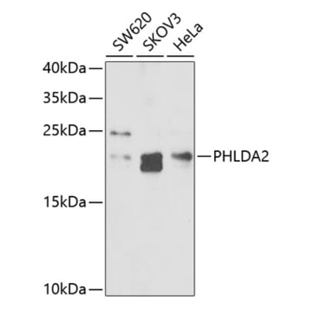 Western Blot - Anti-TSSC3 Antibody (A9824) - Antibodies.com