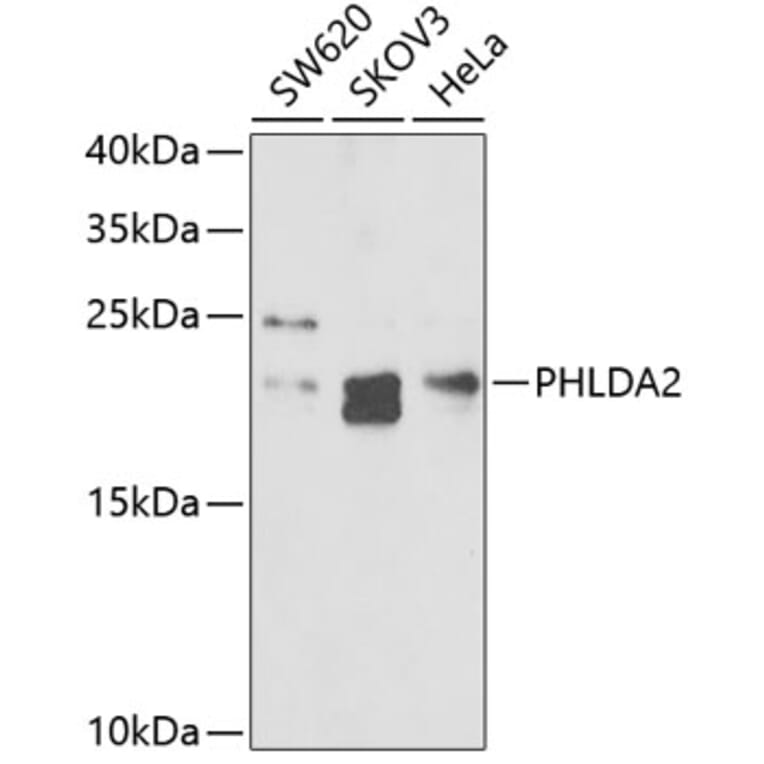 Western Blot - Anti-TSSC3 Antibody (A9824) - Antibodies.com