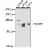 Western Blot - Anti-TSSC3 Antibody (A9824) - Antibodies.com