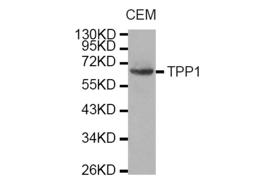 Western Blot - Anti-TPP1 Antibody (A6269) - Antibodies.com