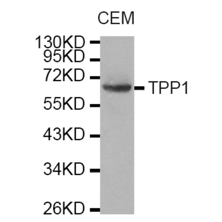 Western Blot - Anti-TPP1 Antibody (A6269) - Antibodies.com