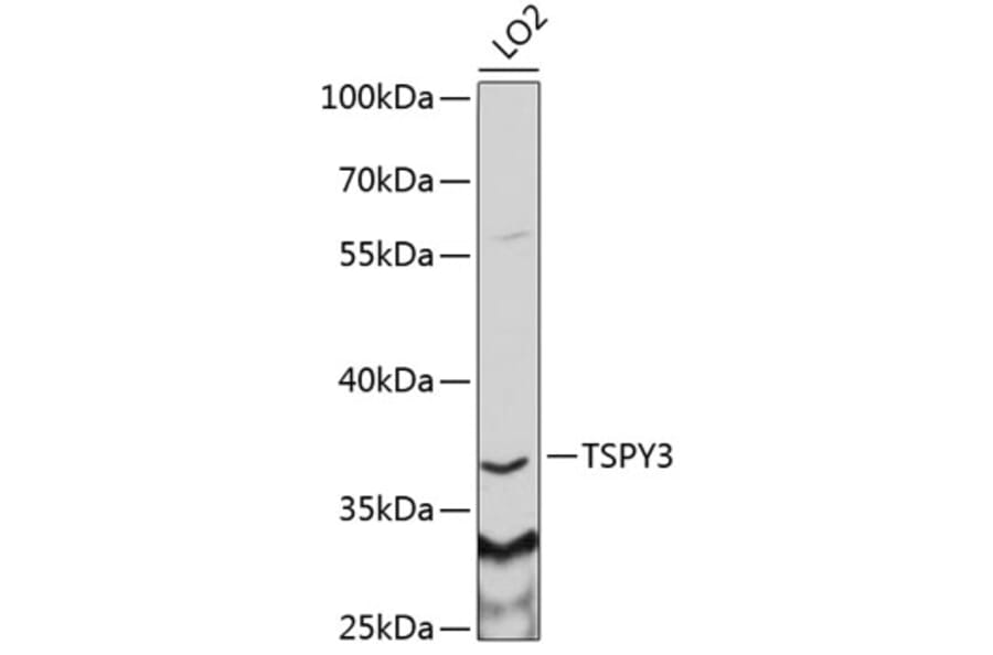 Western Blot - Anti-TSPY3 Antibody (A6270) - Antibodies.com