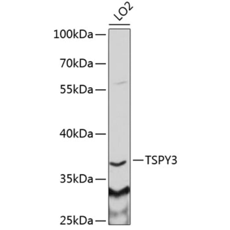 Western Blot - Anti-TSPY3 Antibody (A6270) - Antibodies.com