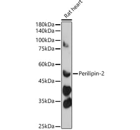 Western Blot - Anti-ADFP Antibody (A9828) - Antibodies.com