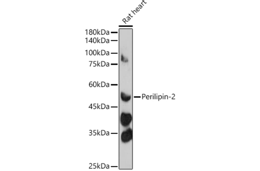 Western Blot - Anti-ADFP Antibody (A9828) - Antibodies.com