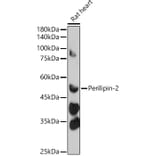 Western Blot - Anti-ADFP Antibody (A9828) - Antibodies.com