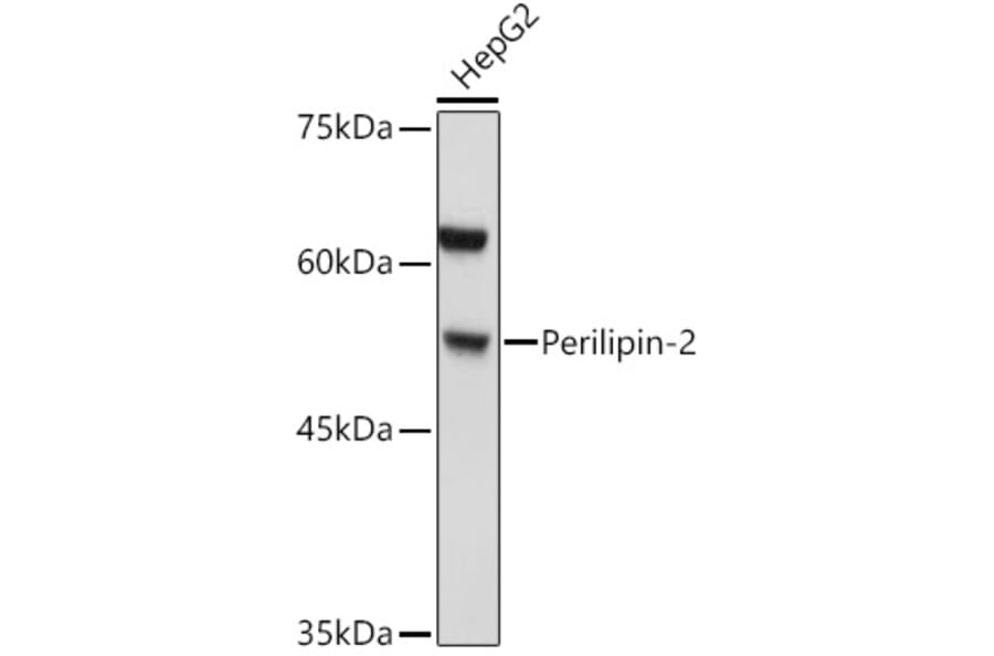 Western Blot - Anti-ADFP Antibody (A9828) - Antibodies.com
