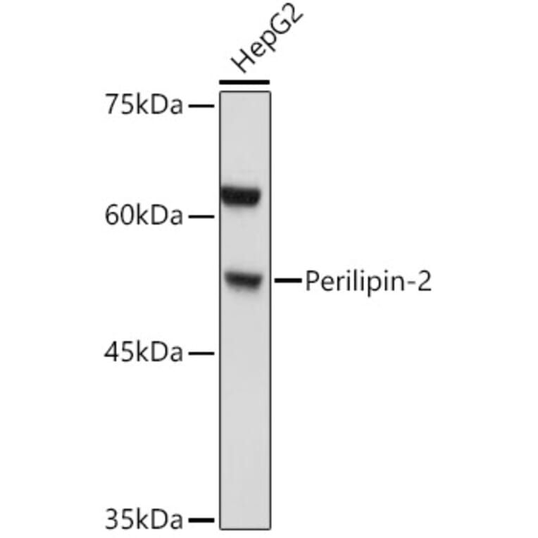 Western Blot - Anti-ADFP Antibody (A9828) - Antibodies.com