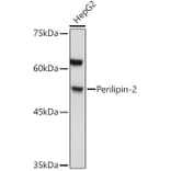 Western Blot - Anti-ADFP Antibody (A9828) - Antibodies.com