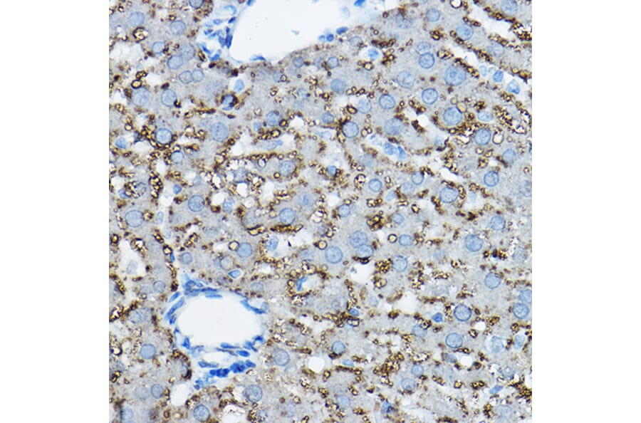 Immunohistochemistry - Anti-ADFP Antibody (A9828) - Antibodies.com
