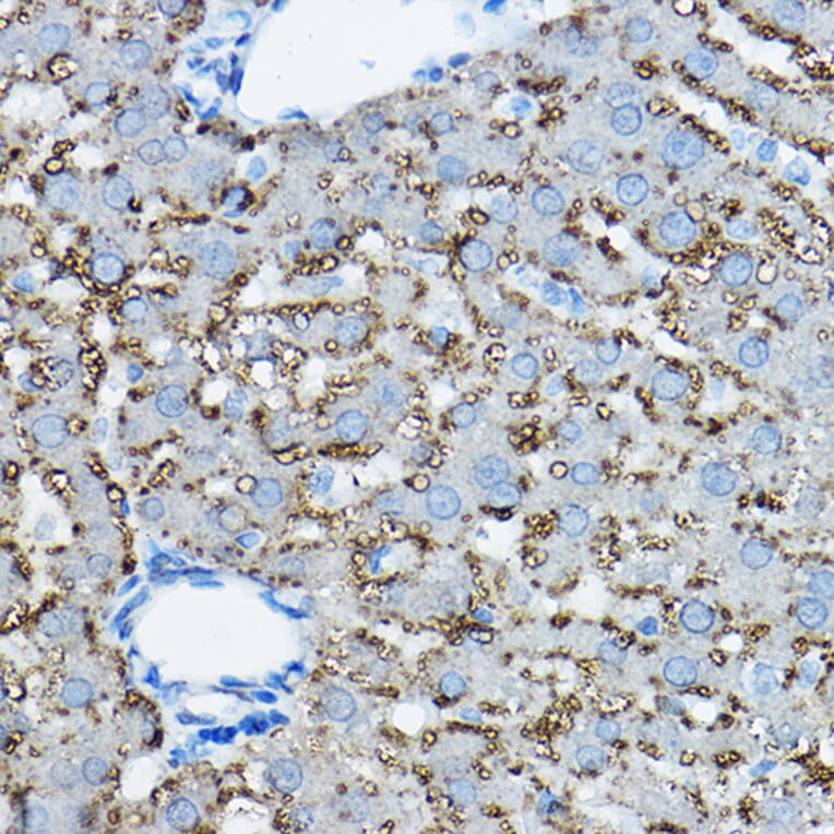 Immunohistochemistry - Anti-ADFP Antibody (A9828) - Antibodies.com
