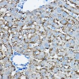 Immunohistochemistry - Anti-ADFP Antibody (A9828) - Antibodies.com