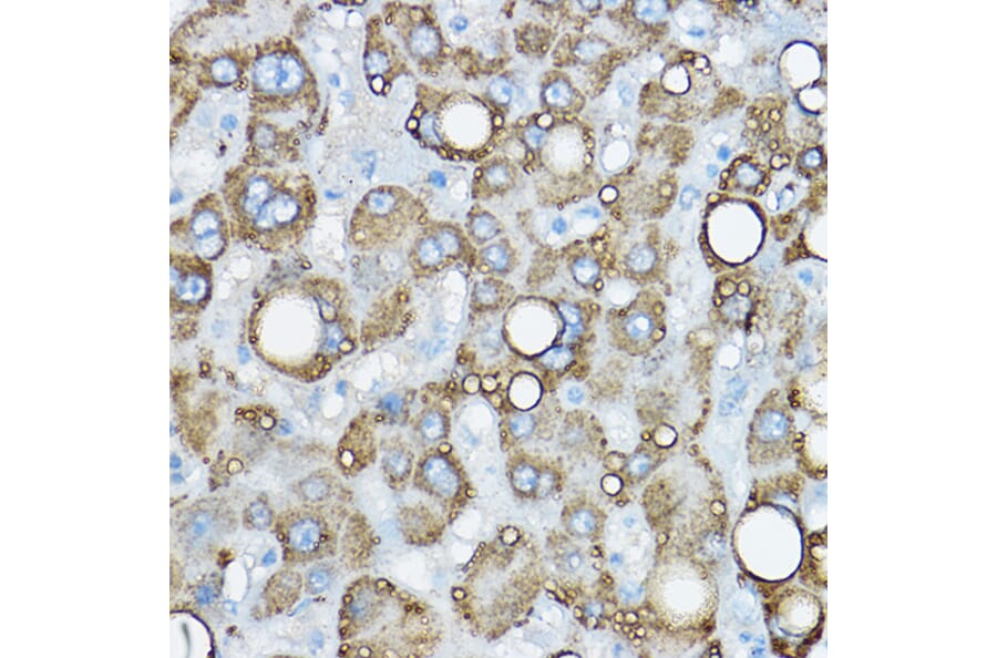 Immunohistochemistry - Anti-ADFP Antibody (A9828) - Antibodies.com