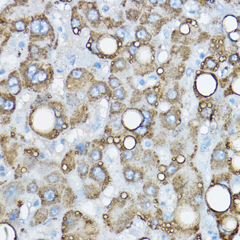 Immunohistochemistry - Anti-ADFP Antibody (A9828) - Antibodies.com