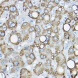 Immunohistochemistry - Anti-ADFP Antibody (A9828) - Antibodies.com