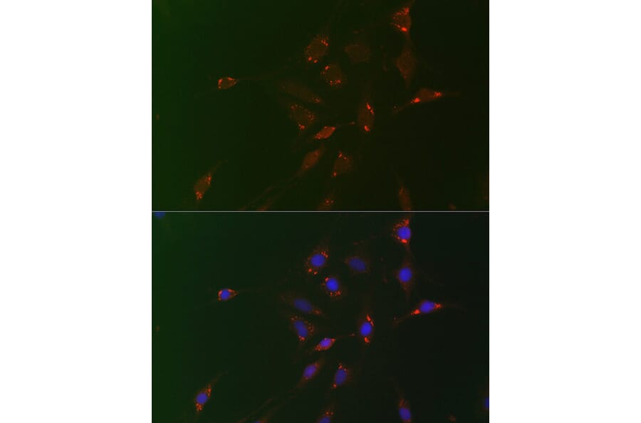 Immunofluorescence - Anti-ADFP Antibody (A9828) - Antibodies.com