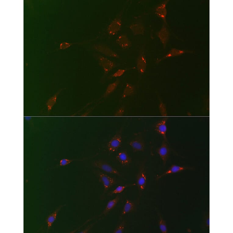 Immunofluorescence - Anti-ADFP Antibody (A9828) - Antibodies.com
