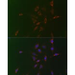 Immunofluorescence - Anti-ADFP Antibody (A9828) - Antibodies.com